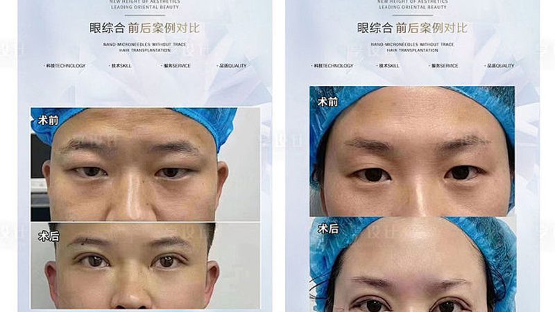 揭秘上海热玛吉：一次价格背后的技术秘密
