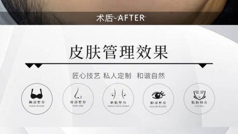 注射美容，价格几何？揭秘注射美容费用构成**