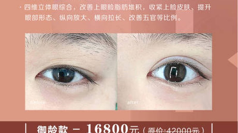 宁波下巴玻尿酸注射：了解差异，选择最佳方案