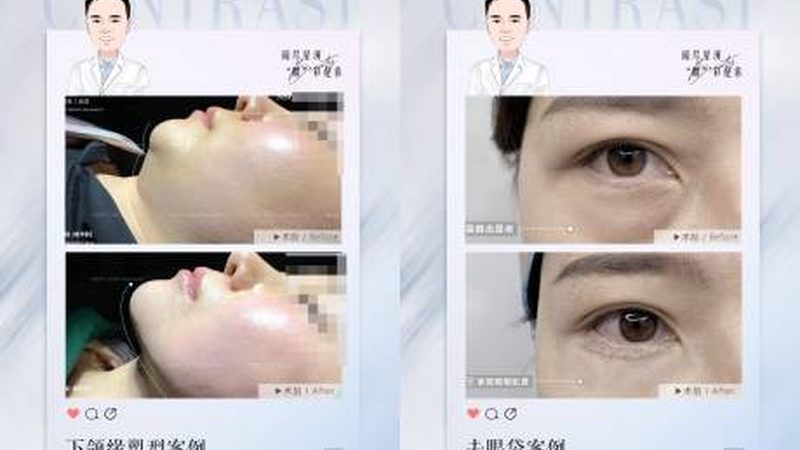 脱毛仪和美容院光电脱毛到底差在哪