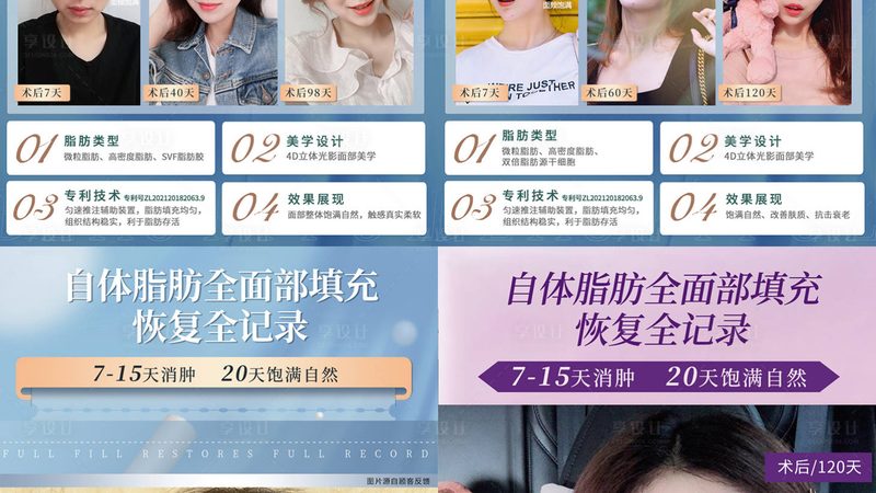 敷15分钟还是20分钟？揭秘抗衰面膜的最佳敷膜时间**