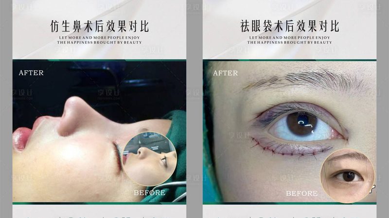 并非所有双眼皮手术术后患者都适合使用中药方子。一般来说，以下人群可以考虑使用：