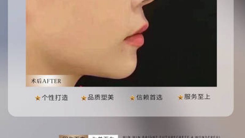 激光祛斑治疗：了解次数与效果的关键因素**