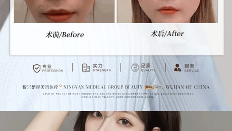 医疗美容咨询师：揭秘工作内容与规范