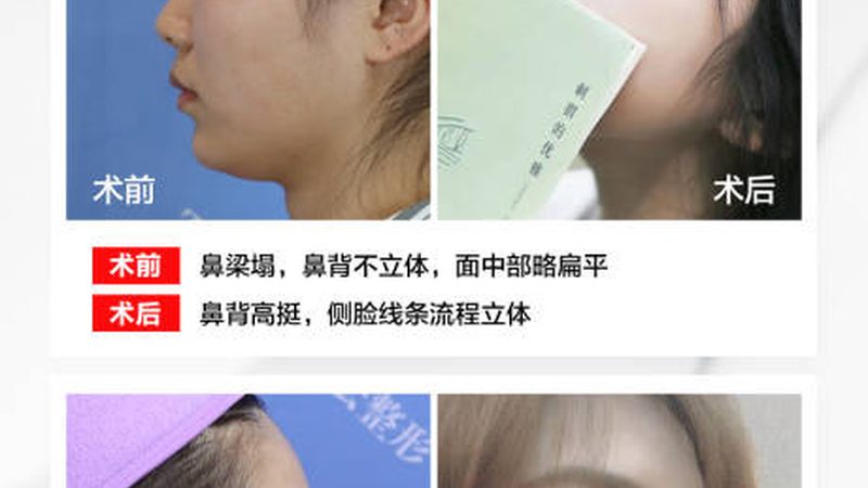 大V线与小V线：揭秘它们之间的区别与安全性**