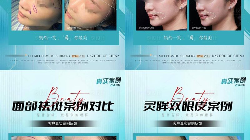 医美与生美，安全之辨：揭秘两者差异与选择要点