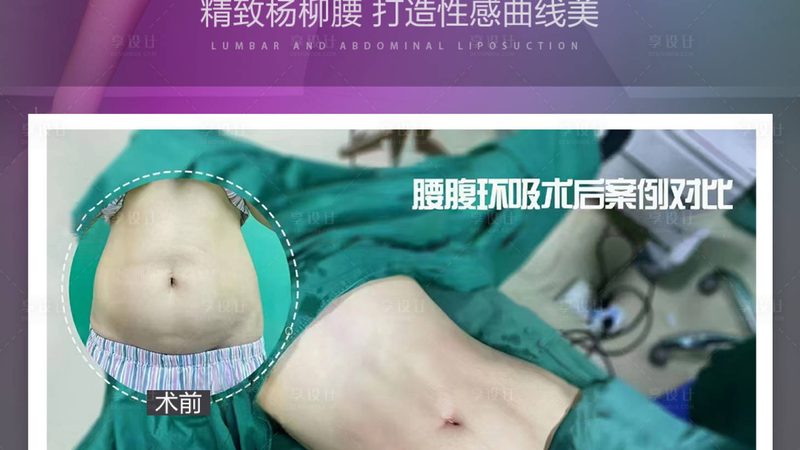 医美咨询师VS美容顾问：揭秘两者间的关键差异