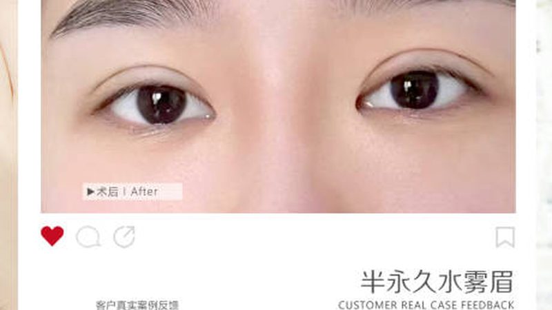 皮肤管理设备定制与代理：揭秘定制化美容科技背后的秘密