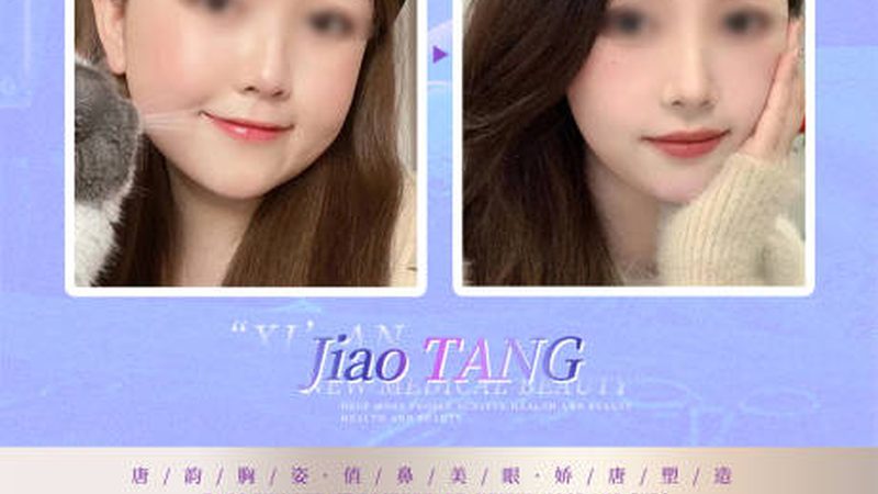 激光祛斑，揭秘北京优质医院的选择标准