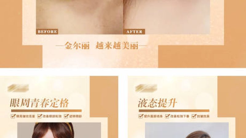 超声炮代理怎么选