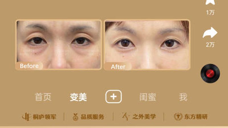 美容院激光脱毛VS家用脱毛仪：揭秘两者差异与选择要点