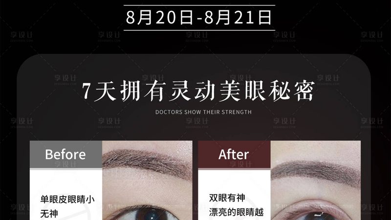 NM激光脱毛机：揭秘其工作原理与选购要点**