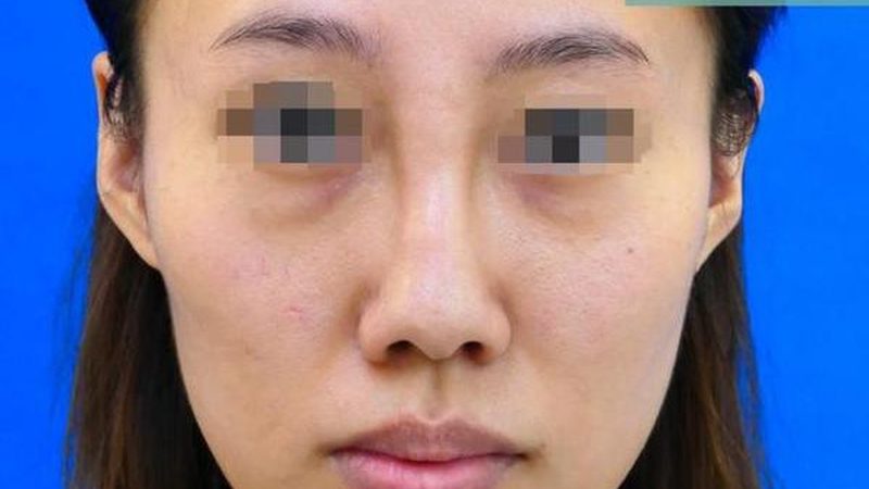 2025轻医美价格表：揭秘价格背后的注意事项